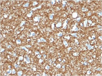 p14ARF Antibody / CDKN2A