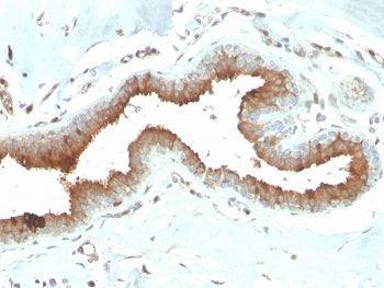 Mammaglobin A Antibody / SCGB2A2