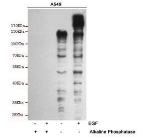 Western blot analysis of extracts from A549 cells, untreated and treated with Epidermal Growth Facto