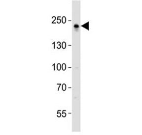 ZO-1 Antibody (TJP1)