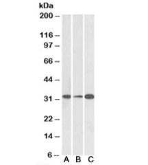 Western blot testing of human [A], mouse [B] and rat [C] brain lysate with EB3 antibody at 0.1ug/ml.