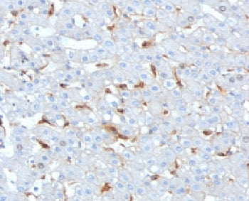 C1QB Antibody / Complement C1q B-Chain