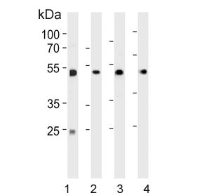 Western blot testing of 1) human Jurkat, 2) human MCF7, 3) human U-251 and 4) mouse brain lysate wit