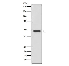 Western blot testing of human LNCaP cell lysate with uPA antibody. Predicted molecular weight ~48 kD
