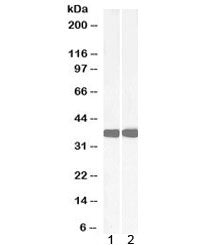 Western blot testing of 1) mouse liver and 2) rat liver lysate with Arginase antibody at 0.05ug/ml. 