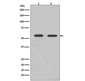 Western blot testing of 1) mouse brain and 2) human HEK293 lysate with Fyn antibody. Predicted molec
