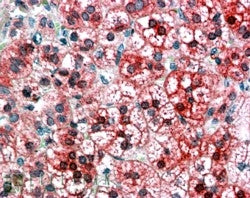 IHC testing of FFPE human adrenal cortex with AXIN1 antibody at 4ug/ml. HIER: steamed with pH6 citra