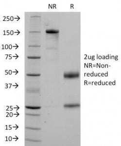 SDS-PAGE Analysis of Purified, BSA-Free CD36 Antibody (clone 1A7). Confirmation of Integrity and Pur