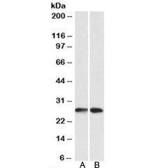 Western blot testing of A549 [A] and HeLA [B] lysates with NNMT antibody at 0.1ug/ml. Predicted mole