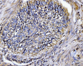 BIN1 Antibody / Myc box-dependent-interacting protein 1