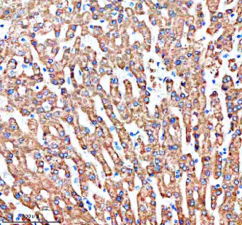 Immunohistochemical staining of SHARPIN using anti-SHARPIN antibody. SHARPIN was detected in a paraf