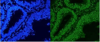 hnRNP A1 Antibody
