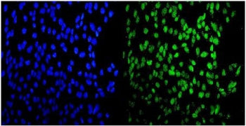 MEF2A Antibody / Myocyte-specific enhancer factor 2A