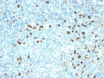 IHC: Formalin-fixed, paraffin-embedded human tonsil stained with anti-Kappa antibody (clone SPM558).