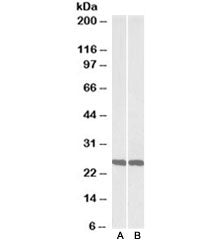 Western blot testing of mouse [A] and rat [B] brain lysate with UCHL1 antibody at 0.01ug/ml. Predict
