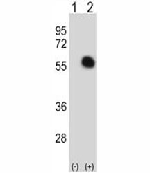 Western blot analysis of GATA2 antibody and 293 cell lysate either nontransfected (Lane 1) or transi