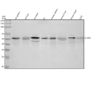 Western blot analysis of Phospho-RIP3 (S232) using anti-Phospho-RIP3 (S232) antibody. Lane 1: rat sp