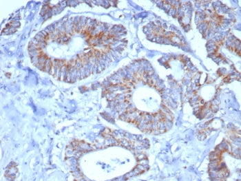 SDHA Antibody