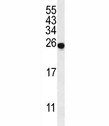SPR Antibody