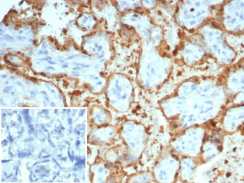 IHC staining of FFPE human placental tissue with S100A12 antibody (clone S100A12/4514). Inset: PBS u
