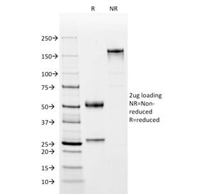 SDS-PAGE analysis of purified, BSA-free C4d antibody (clone C4D204) as confirmation of integrity and