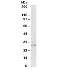RHOGDI Antibody