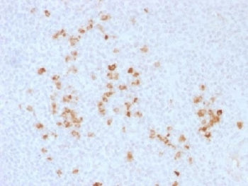 IHC testing of human tonsil and IgG antibody. Required HIER: boil tissue sections in 10mM citrate bu