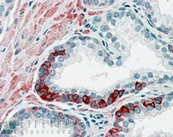 ADAM12 Antibody