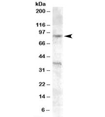 Western blot testing of A549 cell lysate with EXO1 antibody at 0.2ug/ml. The expected 94-115 kDa ban