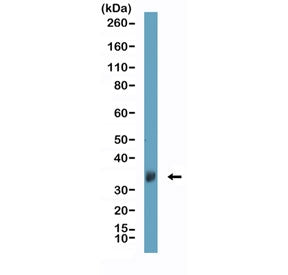 Western blot testing of human brain tissue with recombinant Clusterin antibody at 1:1000. Predicted 