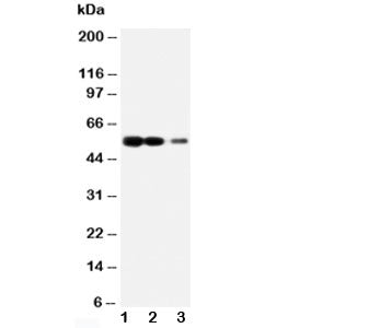 RAGE Antibody