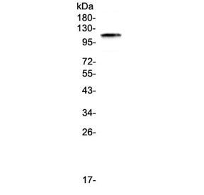 Western blot testing of human HeLa cell lysate with BCMA antibody at 0.5ug/ml. Expected molecular we