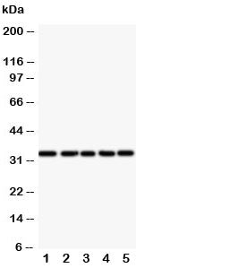 Western blot testing of E2F6 antibody and Lane 1: HeLa; 2: COLO320; 3: A549; 4: MCF-7; 5: SMMC-7721 