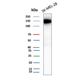 Western blot testing of human SK-MEL-28 cell lysate with Biliary glycoprotein 1 antibody (clone CEAC