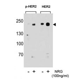 Western blot analysis of extracts from T47D cells, untreated or treated with NRG, using p-HER2 antib