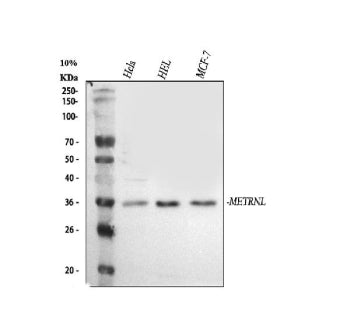 Western blot analysis of Meteorin-like/METRNL using anti-METRNL antibody. Lane 1: human Hela whole c