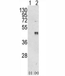 Western blot analysis of CEBPB antibody and 293 cell lysate either nontransfected (Lane 1) or transi