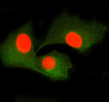 Immunofluorescent staining of SMTN using anti-SMTN antibody (red) and anti-Beta Tubulin antibody (gr