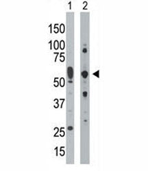PRKR antibody used in western blot to detect PRKR/PKR in mouse uterus tissue lysate (Lane 1) and Hep