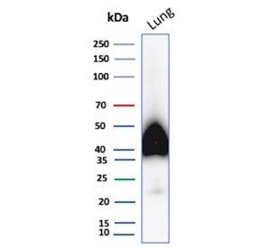 Western blot testing of human lung tissue lysate with Podoplanin antibody. Predicted molecular weigh