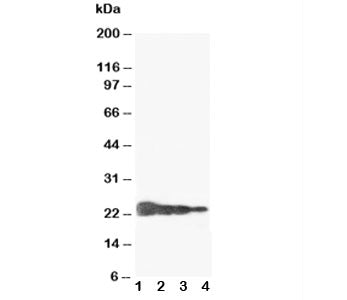 Western blot testing of Growth Hormone antibody and Lane 1: Recombinant human GH protein 10ng; 2: 5n