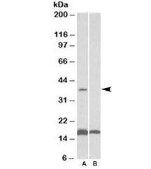 Western blot testing of human frontal cortex lysate with CD57 antibody at 0.1ug/ml with [B] and with
