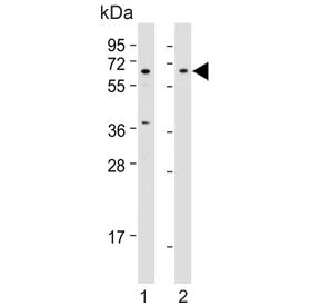 Western blot testing of human 1) HepG2 and 2) HEK293 cell lysate with Beta-TrCP antibody. Predicted 