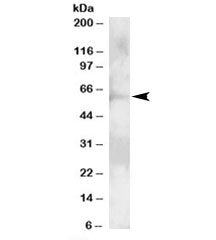 Western blot testing of A431 lysate with GRB7 antibody at 2ug/ml. Predicted molecular weight: ~60kDa