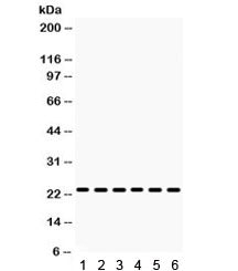 Western blot testing of 1) mouse liver, 2) mouse kidney, 3) mouse testis, 4) human 22RV1, 5) human M