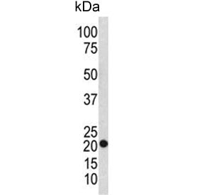 Western blot testing of human SK-BR-3 cell lysate with TAGLN antibody. Predicted molecular weight ~2