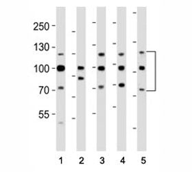 Fibroblast growth factor receptor 1 Antibody (FGFR1)