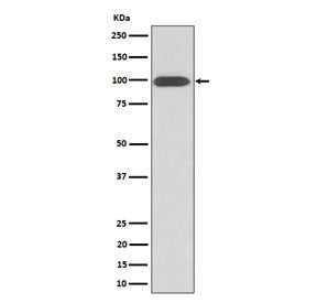 Western blot testing of human U-87 MG cell lysate with Integrin beta 3 antibody. Predicted molecular