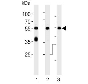 Western blot testing of 1) human brain, 2) mouse brain and 3) rat brain lysate with PACSIN1 antibody