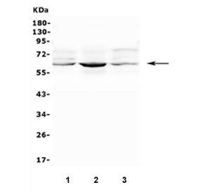 Western blot testing of human 1) A549, 2) PC-3 and 3) U-2 OS cell lysate with SMOX antibody. Predict